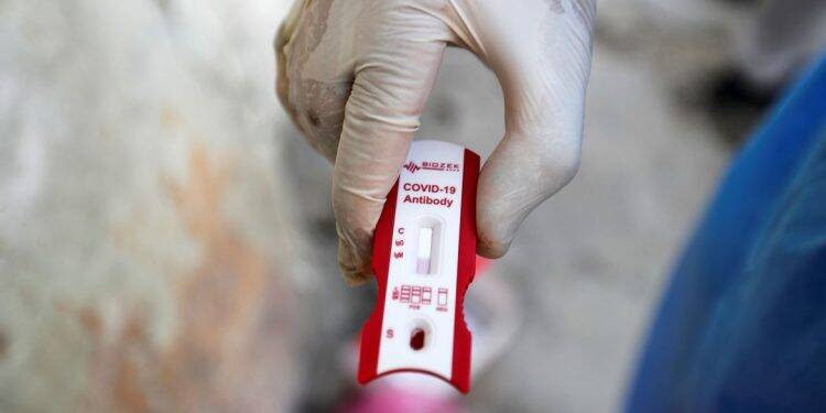 Governo anuncia parceria para produzir vacina contra covid-19